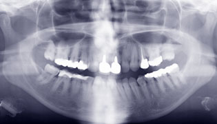 roentgen02